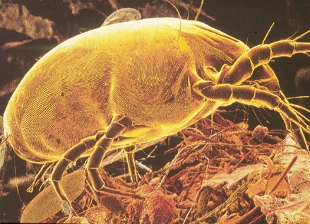 a zoomed in picture of a dust mite